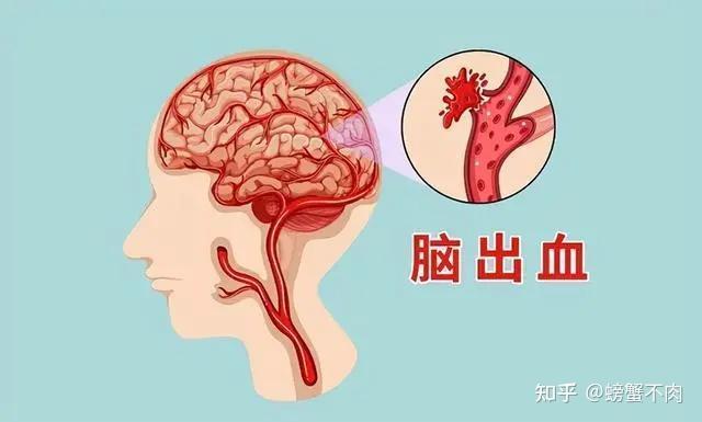 高血压的危害你注意了吗？
